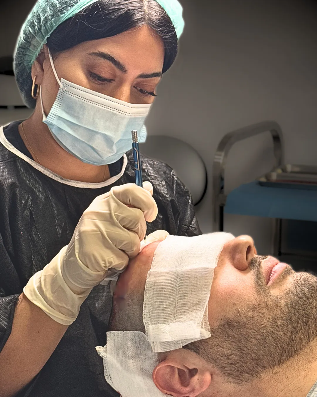 Doctor performing hair transplant at HM Hair Transplantation