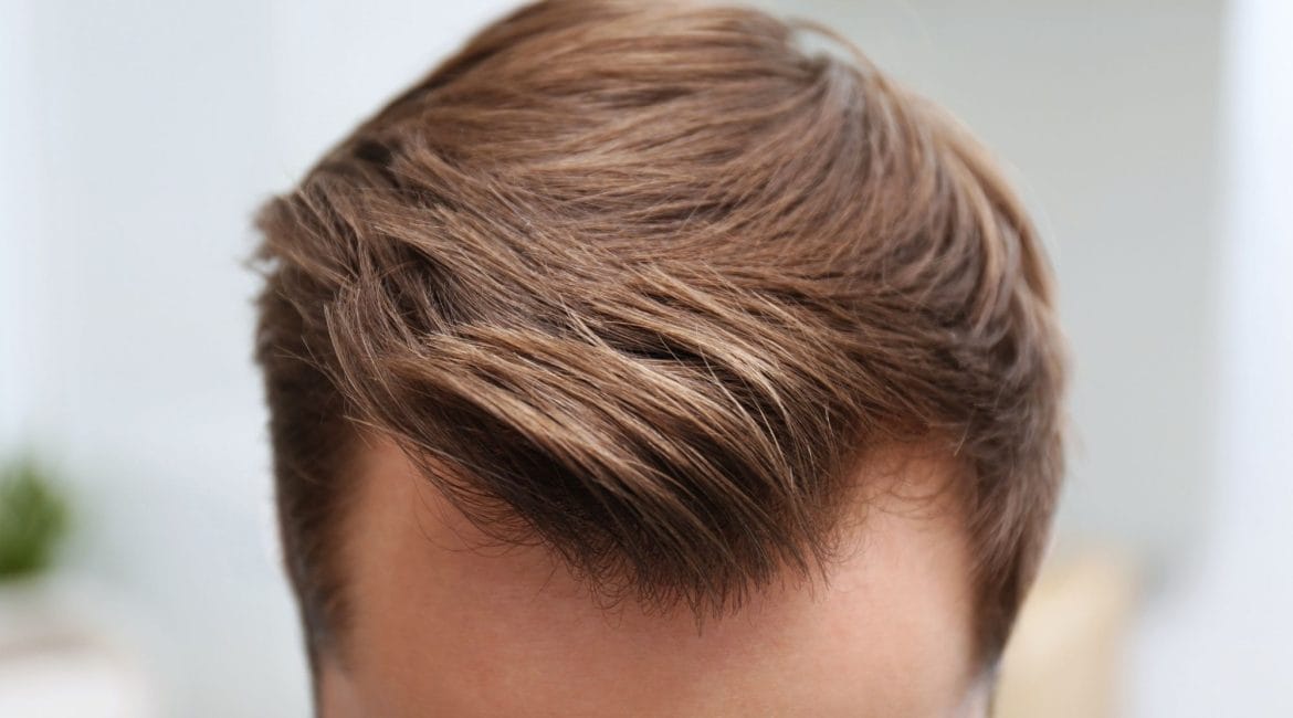 Aftercare after hair transplant